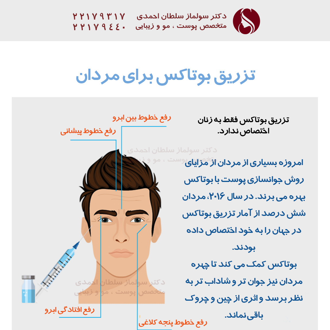 تزریق بوتاکس برای مردان