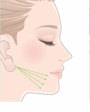 لیفت خط فک با نخ