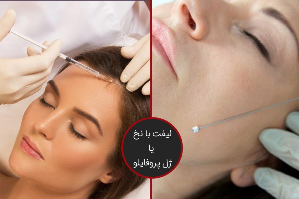 نخ یا پروفایلو