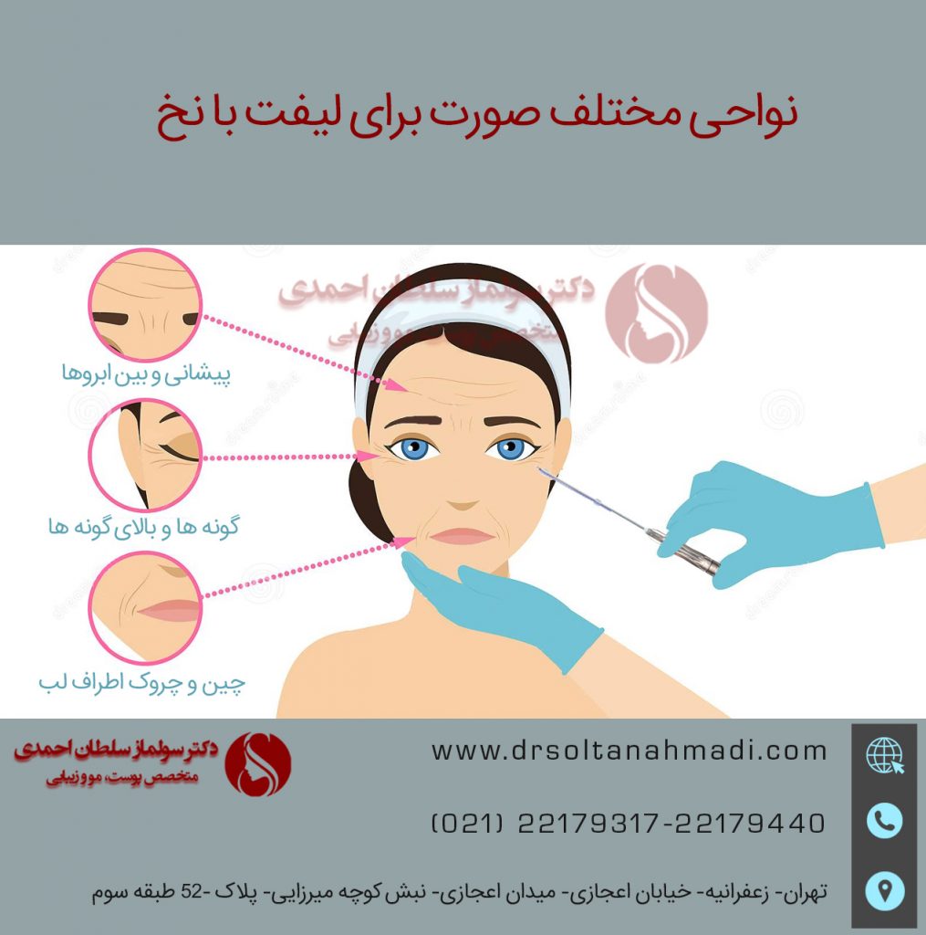 نواحی مختلف لیفت