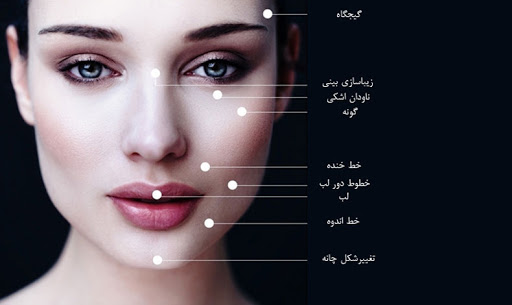 تزریق ژل به قسمت های مختلف صورت