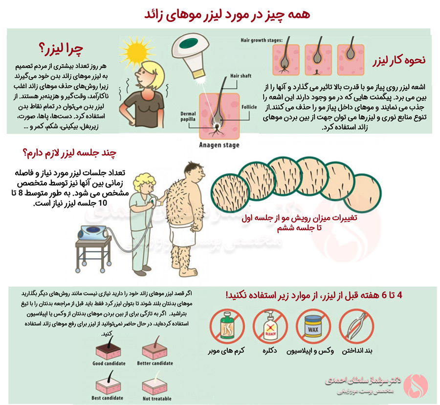 اینفوگرافیک لیزر موهای زائد