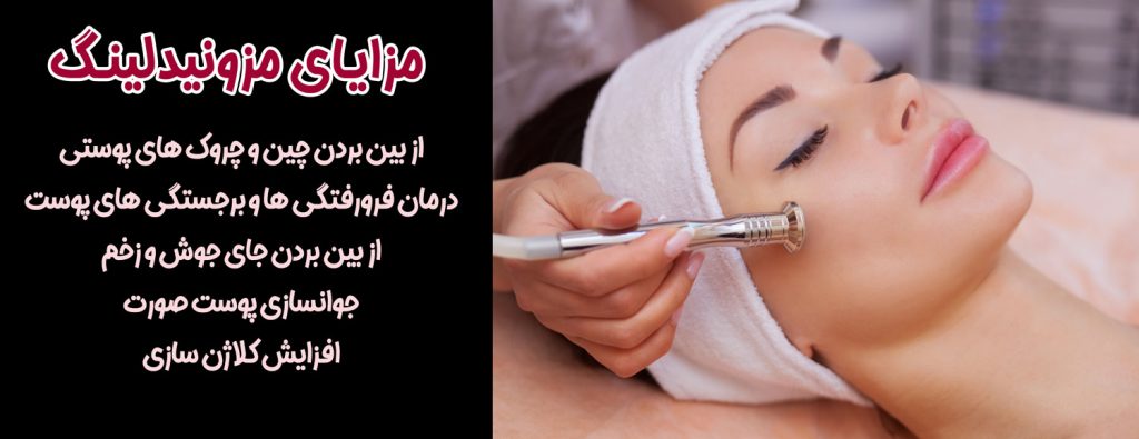 مزونیدلینگ
