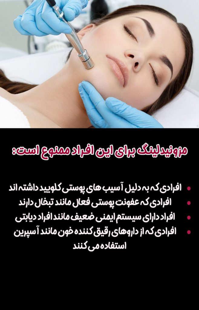 ممنوعیت مزونیدلینگ