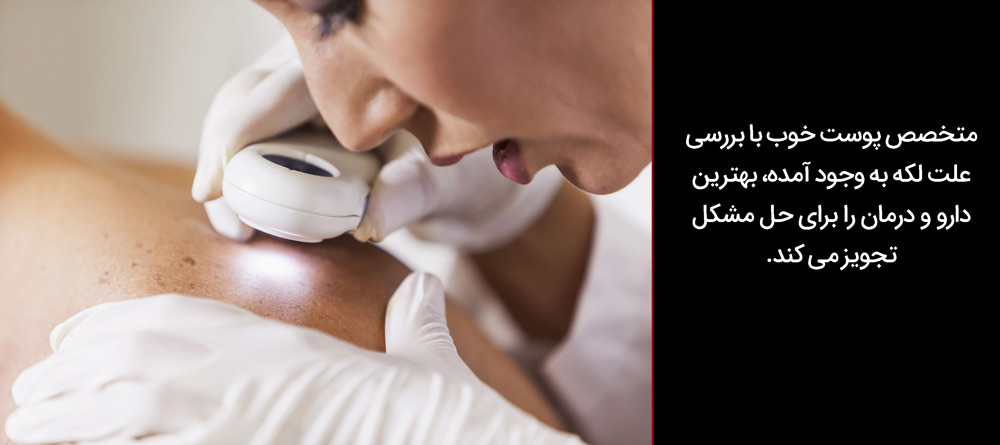 بهترین متخصص پوست برای درمان لک