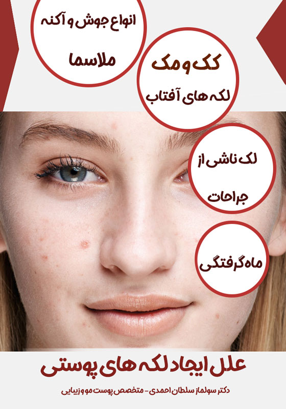 علت لک پوستی