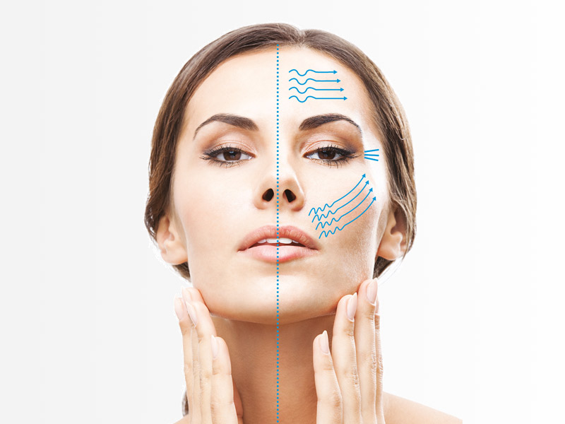 هایفوتراپی؛ روشی نوین برای جوانسازی پوست