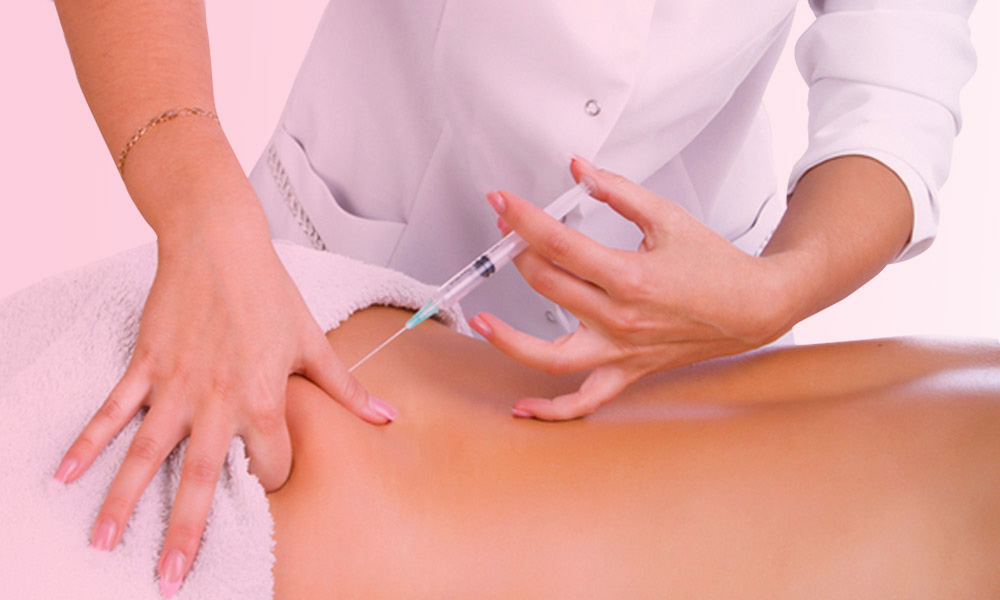 مزوتراپی باسن