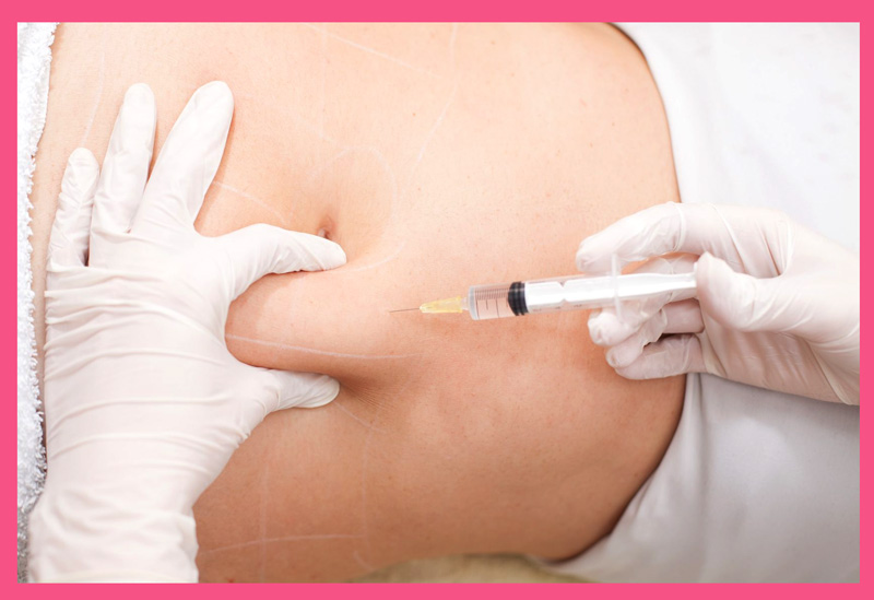 مزوتراپی شکم