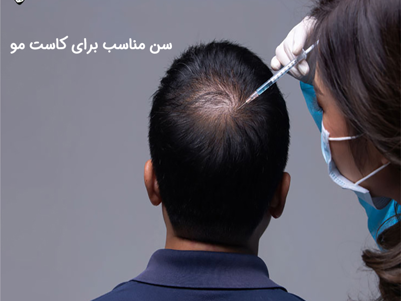 بهترین سن برای کاشت مو چه زمانی است؟