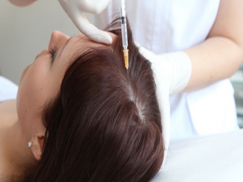 PRP در مقابل مزوتراپی
